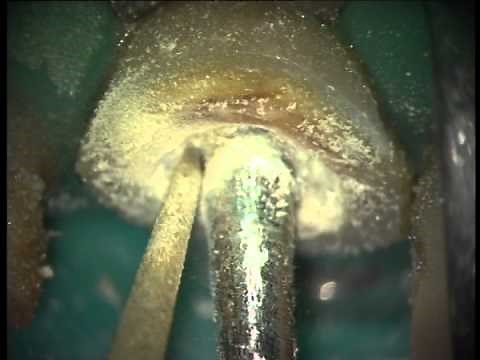 Utilisation de l'extracteur de Gonon