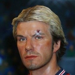 10 most bizarre football injuries ever