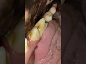 Golden retriever mouthcam 2