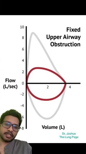 Flow Volume Loop - Fixed airway Obstruction #lunghealth #pulmonology #doctor #lungfunction #mbbs