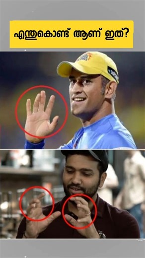 എന്തുകൊണ്ട് ആണ് dhoni യുടെ വിരലുകൾ ഇങ്ങനെ?