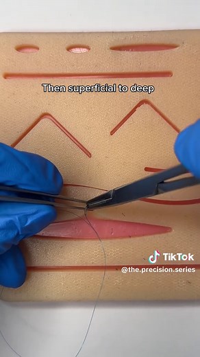 Mastering Deep Dermal Sutures for Surgical Success