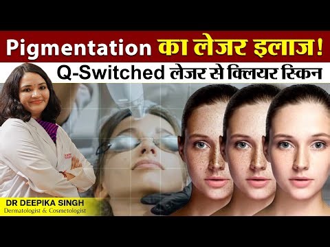 Q-Switched Laser Treatment क्या है? फायदे, प्रक्रिया और Side Effects पूरी जानकारी