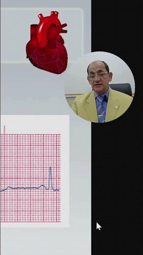 HOW TO INTERPRET ECG (11)