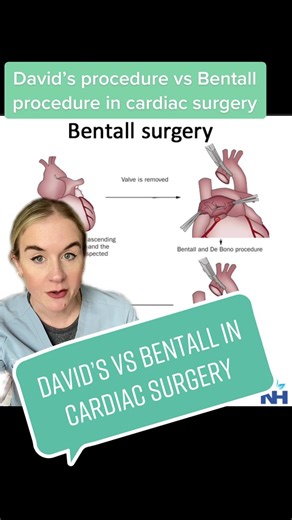 Comparando el Procedimiento de David con el Bentall