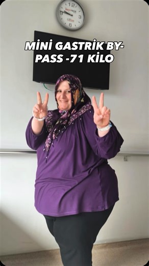 Genel Cerrahi.Dr.Ögretim Üyesi Erkan Aksoy on Instagram: "Sibel Hanım, bypass ameliyatı sonrası 1,5 yılda tam 73 kilo verdi. Bu sadece bir kilo kaybı değil; sağlığına, özgüvenine ve hayatına yeniden kavuşmanın hikayesi. 💪🏻 Trabzon’dan gelip bu cesur adımı atan Sibel Hanım’ı yürekten tebrik ediyoruz. EA Ekibi olarak bu yolda yanında olmaktan büyük mutluluk duyuyoruz. 🙏🏻 #obezitecerrahisi #tüpmide #bariatrikcerrahi #tüpmideameliyatı #mideküçültme"
