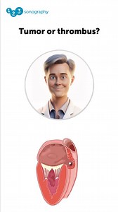 3.3K views · 70 reactions | An incredible echo case: Can you...