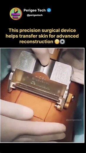 This Device Uses Your Own Skin to Heal You 😳⚙️ #shorts
