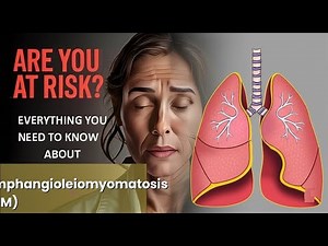 Lymphangioleiomyomatosis (LAM) Explained Causes, Symptoms and Treatment, All Insights