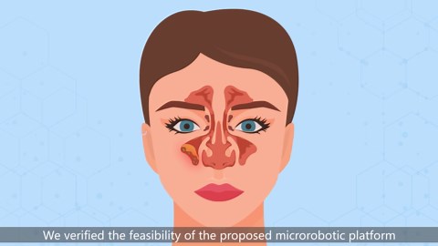 Tiny light-sensitive magnetic robots can clear up bacterial infections in sinuses