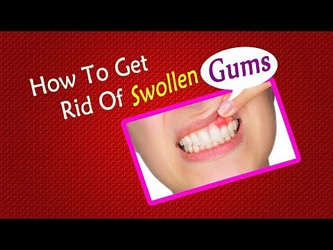 Swollen Gums Remedy That Actually Works!
