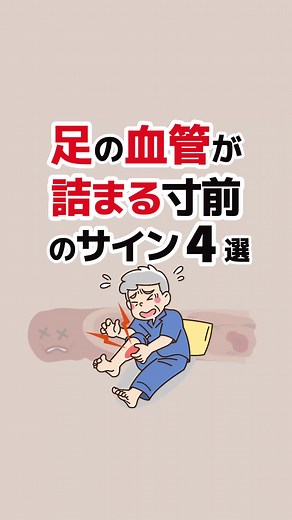 足の血管詰まる寸前のサイン4選