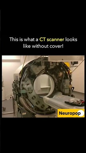 CT Scan: Uncovered Inside! #CTscan #CT scanscanner #medicalimaging #Machinerevealed