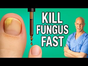 Start This Oil Tonight and Watch Toenail Fungus Fade Away | Dr. Mandell