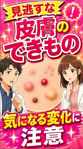 【気になるポツポツは大丈夫？知っておきたい身近な皮膚のできもの12選と受診の目安】◯