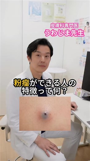 うわじま先生/皮膚科専門医・指導医 on Instagram: "【当てはまったら要注意⚠️】粉瘤ができやすい人の特徴3選 「肌に謎のしこりができて痛い…」 「これ、何？ニキビ？」 それ、もしかして「粉瘤（ふんりゅう）」かも😱💥 皮膚科専門医が教える、粉瘤ができやすい人の共通点👇 ❶ 皮脂が多い人 → 顔・背中・耳の後ろなど、皮脂腺が多い場所は要注意！ ❷ 肌をいじってしまう人 → ニキビ潰し、角栓の押し出し…これ全部NG🙅‍♀️ 刺激が毛穴を傷つけて粉瘤の原因に 顔面や背中の粉瘤の方に多いパターンです☝️ ❸ 摩擦・刺激が多い人 → キツい下着、リュックの擦れ、毎日の髭剃り 知らないうちに肌がダメージを受けてる💦 「これ、全部当てはまる…😭」って人、 まずは「触らない・こすらない」を徹底して！ 下着など素材の見直しも⭕️ 粉瘤は自然には治らないし、 放置すると炎症を起こして激痛に😱 気になるしこりがあったら、早めに皮膚科専門医へ🏥 「これって粉瘤？」て不安な人🌀 一般的な質問はコメント欄でもOKです🙆‍♂️👨‍⚕️ （個別の診察診断希望の方はクリニックへ🏥） 