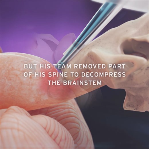 To avoid paralysis | Northwestern Medicine | Facebook