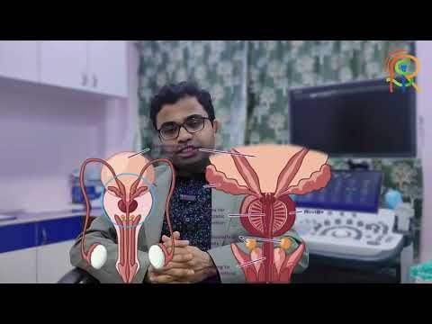 When is Transrectal Ultrasound (TRUS) necessary for men?