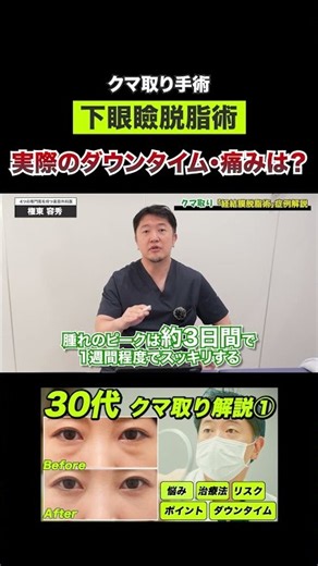 【症例解説③】実際に聞いた！下眼瞼脱脂のダウンタイム&痛みについて