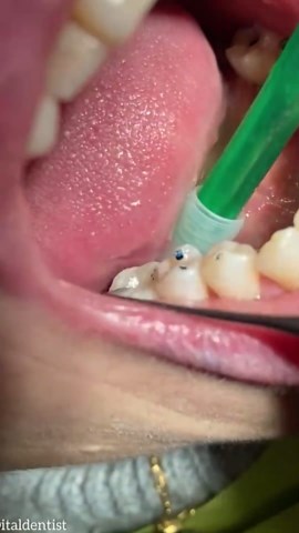 High-Tech Cleaning Tools