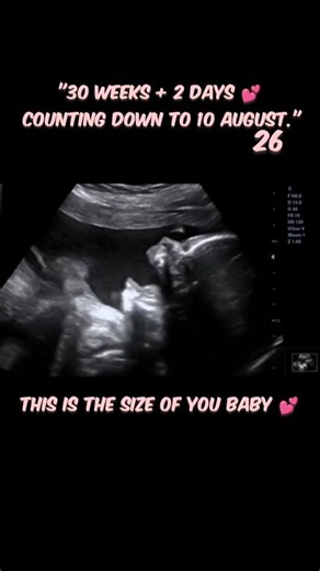 30 weeks, ultrasound #baby #ultrasound #pregnant