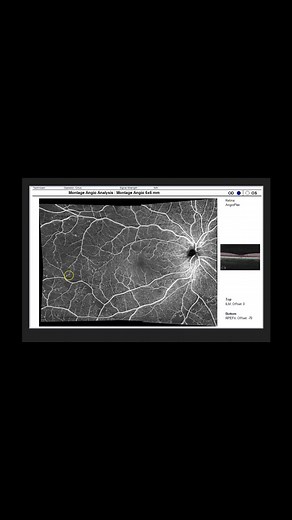 33K views · 389 reactions | Read #OCT images like a pro | EyeCare PD | Facebook
