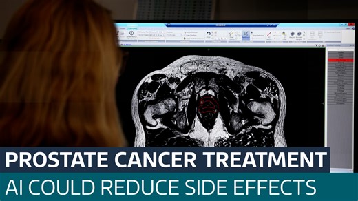 New high-tech prostate cancer treatment using AI being trialled in the UK  - Latest From ITV News