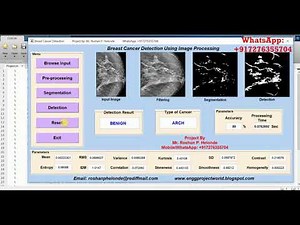 Type of Breast Cancer Detection Using Image Processing Matlab Source Code