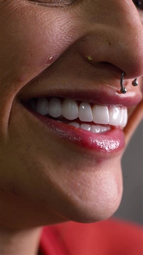 A NEW SMILE IS A NEW BEGINNING.