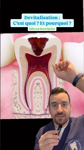 Why is it necessary to devitalize a tooth? What is devitalization?