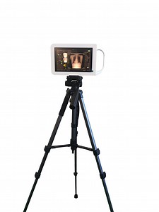 [Hot Item] Medical X Ray Machine Handheld Portable