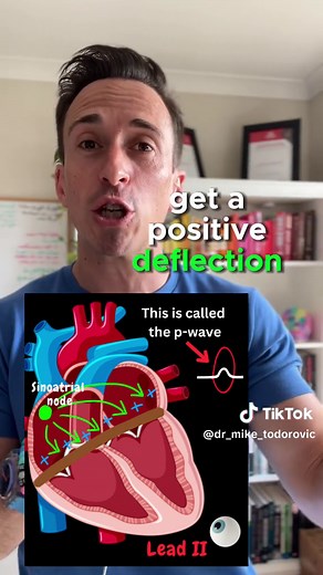 Inderstanding and ECG (EKG) in 3 minutes!