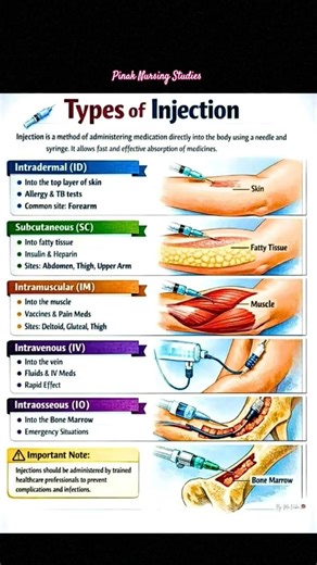 Types of injection