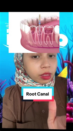 Memahami Proses Root Canal dalam Finding Nemo