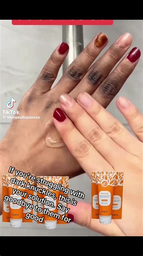 Remove Dark Knuckles Permanently: Home Remedies & Treatments