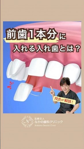 The director explains! What is a denture that fits one front tooth? #Nakano Dental Clinic #Okayam...