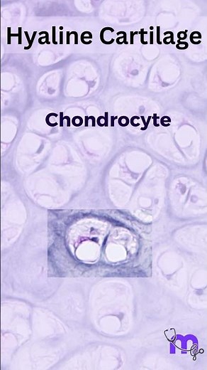 Histology of Hyaline Cartilage