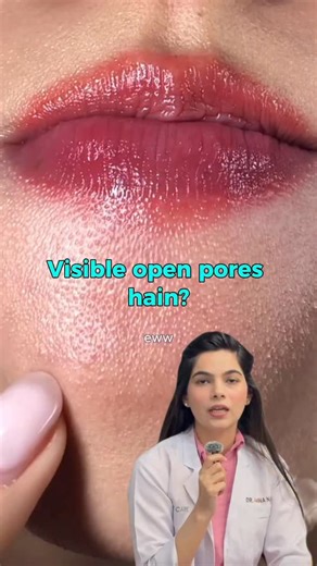 6.9K views · 532 reactions | Open Pores Skin Care Routine | Holistic Care | Facebook