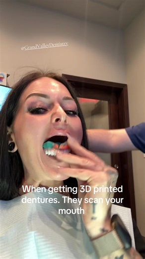 what to expect when getting 3-D digital impressions done for 3-D printed dentures. These dentures will be printed out of resin material. Everything is done digitally to ensure that it’s perfect so when you get your new chompers, everything‘s going to work fine when you go to use them. 3-D digital printed dentures are the best way to go when you need dentures so if you are looking for someone to make you dentures, please ask them if they 3-D print them and if they use a resin material. I got my n