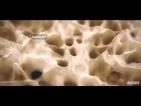 Healing Process of Bone Fracture