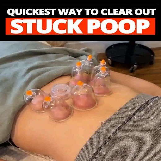 2.2K views · 386 reactions | See how Emma powerfully helps: ✔️Restore regular bowel movements ✔️Reduce painful bloating and constipation ✔️Crush unwanted food cravings and fight harmful gut bacteria Discover EMMA Now! | Emma | Facebook