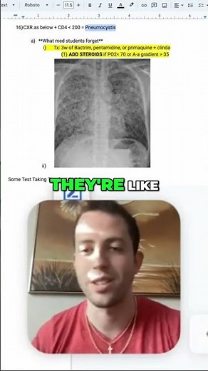 USMLE Infectious Disease: PJP Management Protocol