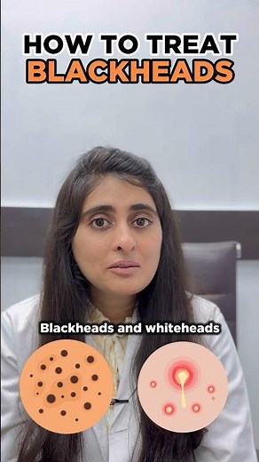 How to get rid of Blackhead | How to remove blackhead from face | Blackhead dermatologist