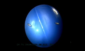 What Kind Of Sick Ishh Is This: Maggots Found Inside Guy's Nose! (By Far One Of The Most Disgusting Things Seen So Far For 2010)