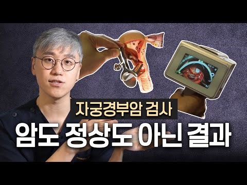 에스쿱스 아니고 아스쿠스? (그게 뭔데..)