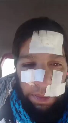 May u think that our people oppose the Taliban only over power-sharing, but that is not the case. The oppression inflicted by the Taliban on our people is severe, beyond the limits.Recently in #Panjshir, Taliban members brutally beat and tortured a farmer nearly to death because he refused them access to the wood from his orchard. This is an example of their violence and shows that resisting them is a necessity.