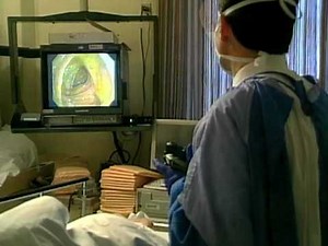 Doctors Debate Benefits, Risks of Virtual Colonoscopy