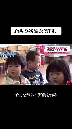 スタージウェーバー症候群の理解と支援