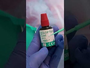 EQUIA, Ionómero de vidrio con nanorelleno. Excelente opción como restaurador en niños.