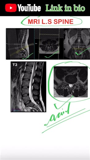 Shubham Deoli on Instagram: "Learn Mri Planning #mri #radiographer #radiology #hospital #mritechnologist"